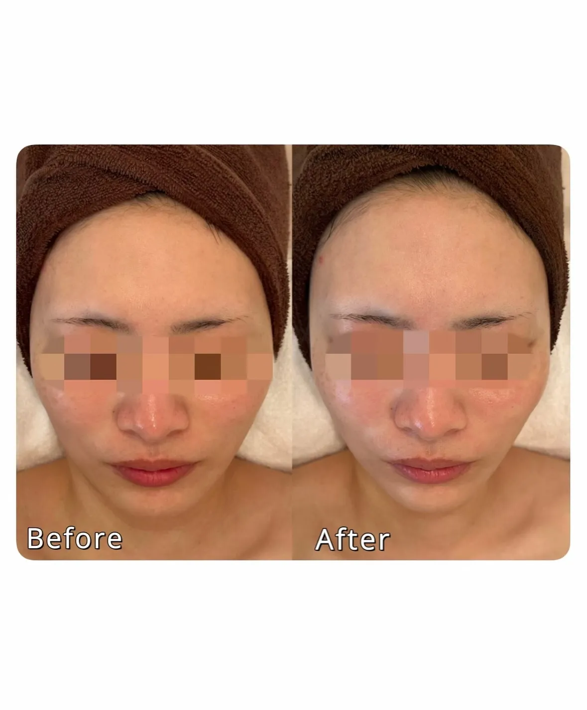 Secret Lift – シークレットリフト